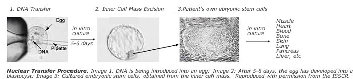Somatic Cell Nuclear Transfer